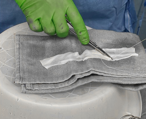 Stitching together and pie crusting two 3x6 STRAVIX Tissue