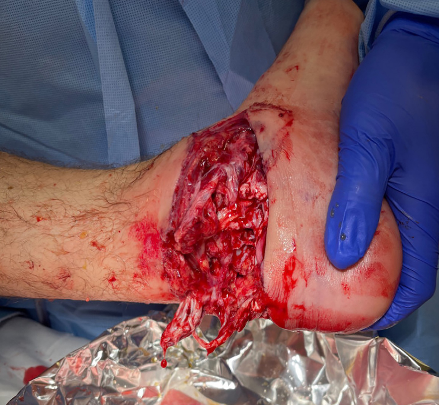 Initial presentation