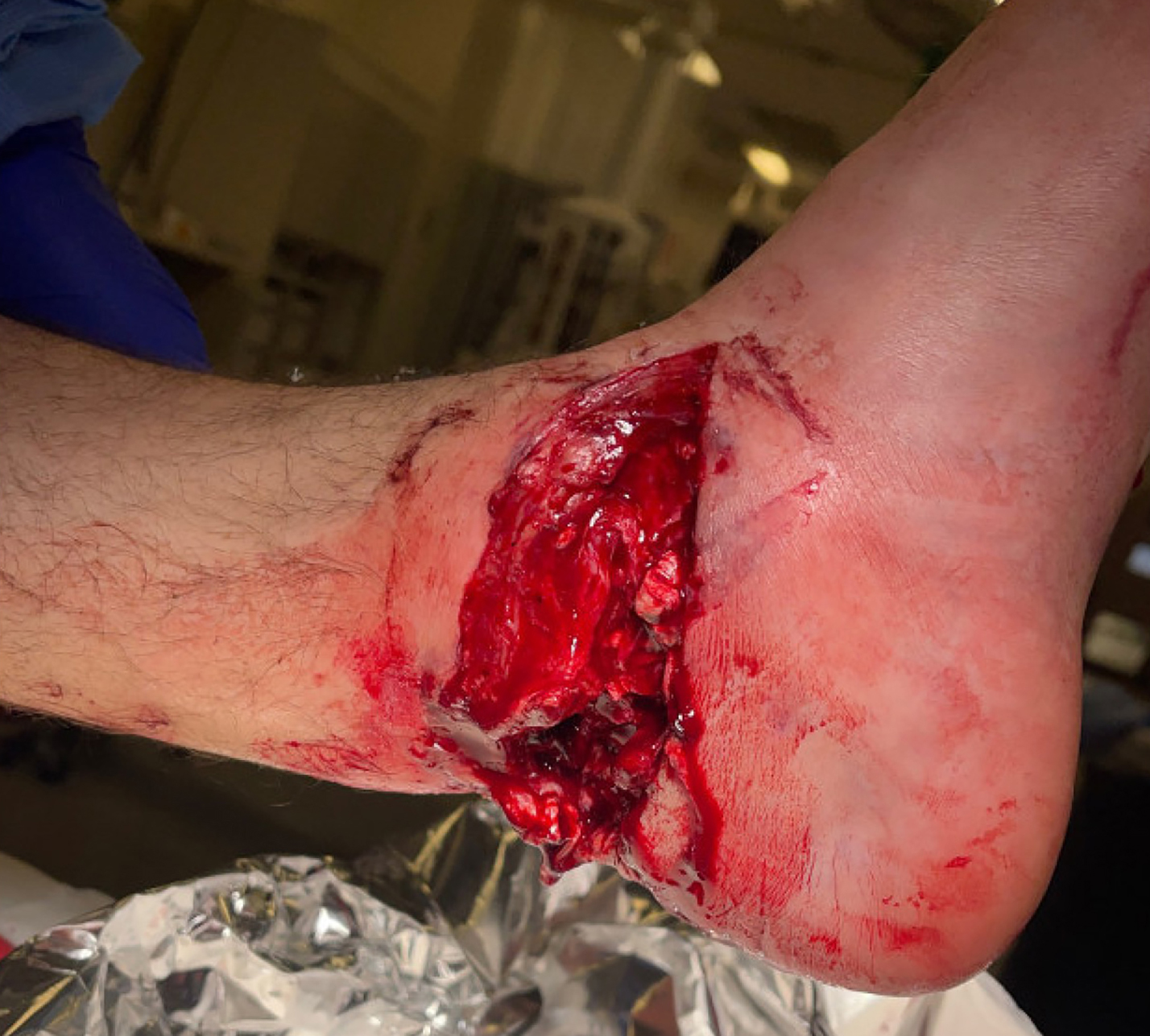 Initial presentation