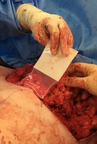 GRAFIX XC Membrane application