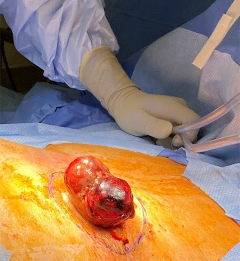 Pre-OP - presentation