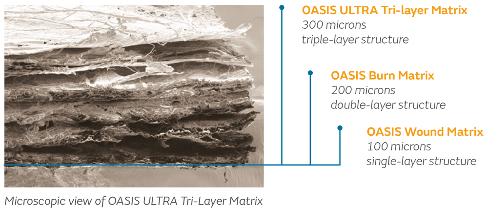 STRAVIX on blue blob