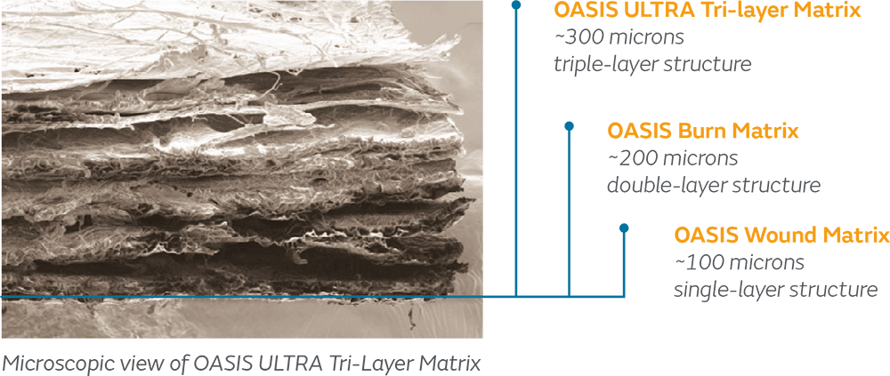 STRAVIX on blue blob